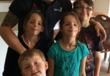 Bonding over Treacher Collins Syndrome