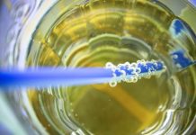 Sugary drink ban calls