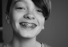 Creating confident smiles